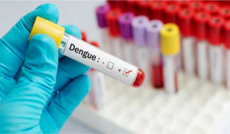 Dengue Myocarditis